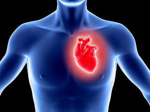  Myocardial Infarction Disease