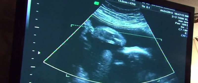 Ohio House committee approves 20-week abortion ban