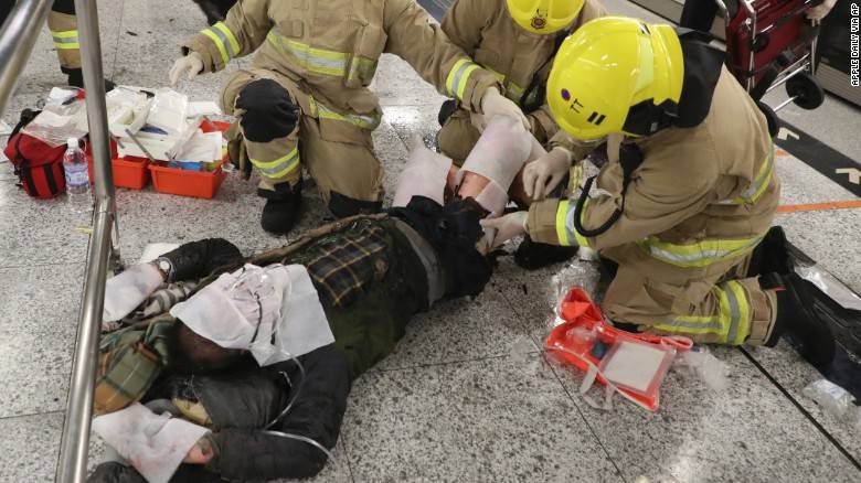 At least 18 injured in fire on Hong Kong metro train