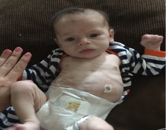 Boy's transformation from drug-addicted newborn to healthy toddler goes viral