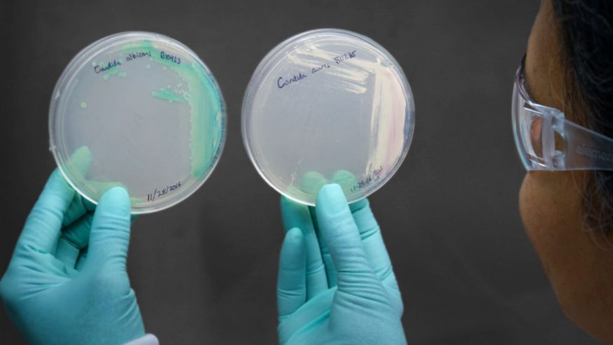 A ‘perfect storm’ superbug: How an invasive fungus got health officials’ attention