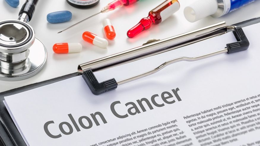 How to spot and treat colorectal cancer