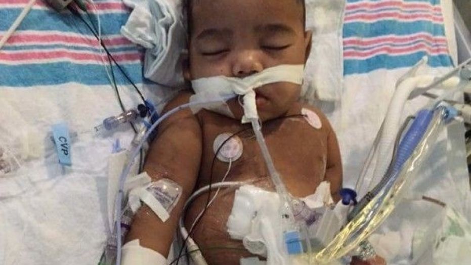 Georgia boy, 2, blocked from getting fathe's kidney, is rushed to hospital