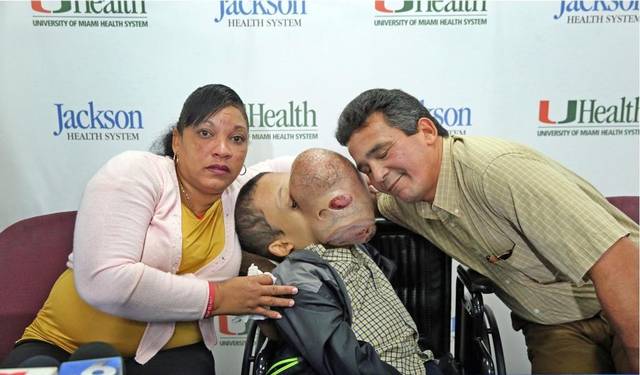 Doctors in Florida to remove 10-pound tumor from boy's face